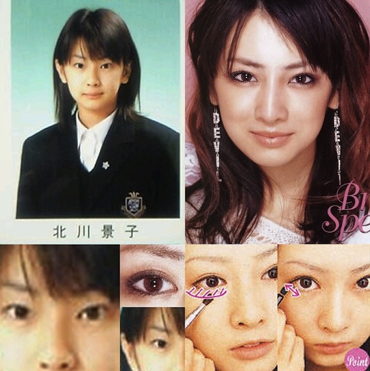 keiko kitagawa plastic surgery 北川景子 整形