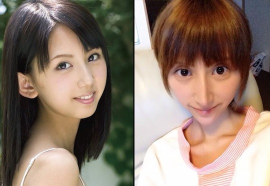 japan porn star rina nanase rumi kanda plastic surgery face