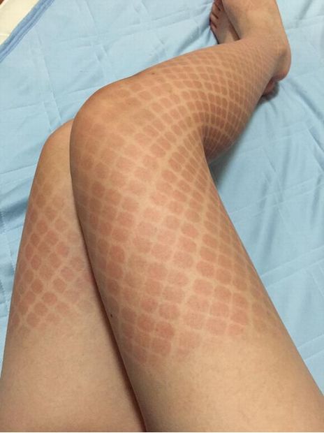 comiket cosplay fishnet stockings sunburn