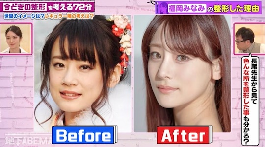 minami fukuoka japanese female celebrity model plastic surgery confess admit secret