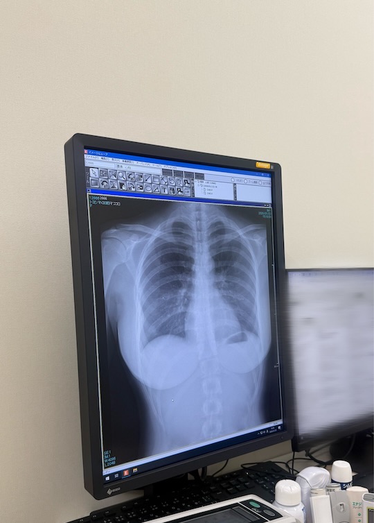 cocoro toyoshima breast chest xray japanese gravure idol gradol bust