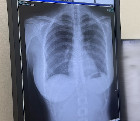 cocoro toyoshima breast chest xray japanese gravure idol gradol bust