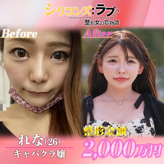 young japanese women plastic surgery hostess influencer model student